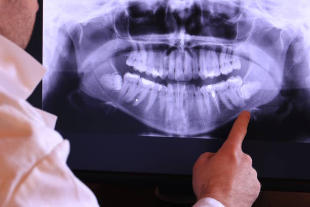 Best Emergency Tooth Extraction  in Lexington, VA
