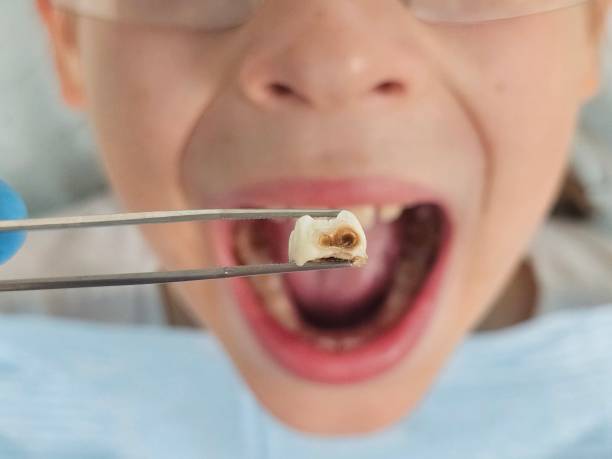 Best Emergency Pediatric Dentist  in Lexington, VA